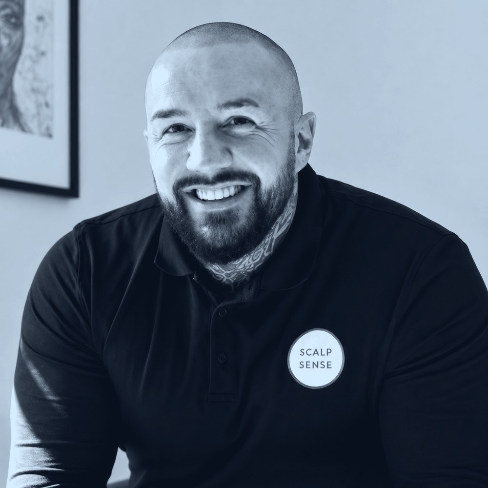 Matt Cunningham, scalp micropigmentation specialist and founder of Scalp Sense in Chelmsford