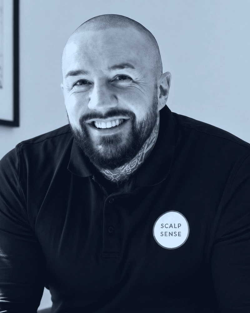 Matt Cunningham, scalp micropigmentation specialist and founder of Scalp Sense in Chelmsford, Essex